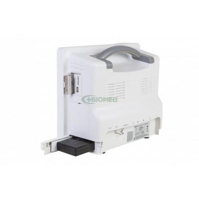 Монітор пацієнта Монітор пацієнта